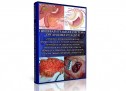 Инфопродукт №13 — Лечение болезней органов и тканей системы Пищеварения – методики